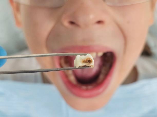 Best Same-Day Emergency Dental Services in Mercedes, TX