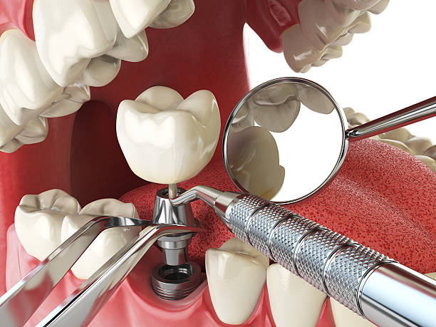 Best Emergency TMJ Treatment in Mercedes, TX